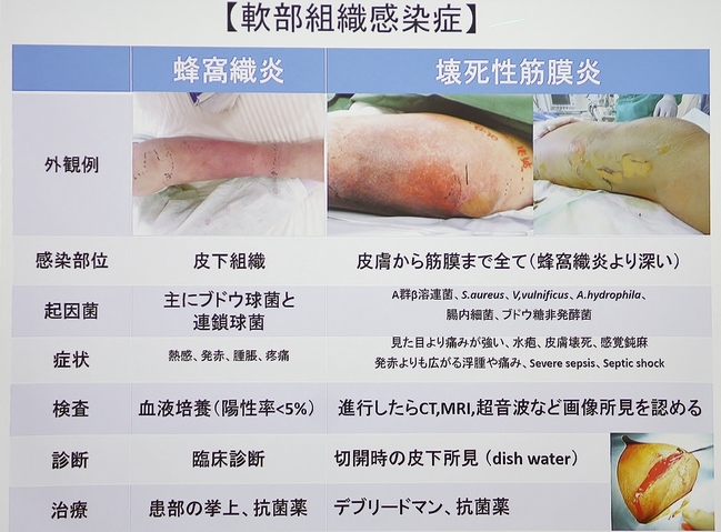 写真５